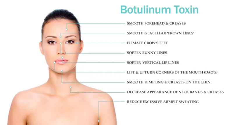 Slimming Anti Wrinkle Beutox Batulaxs Resty Dermal Filler Juvederms